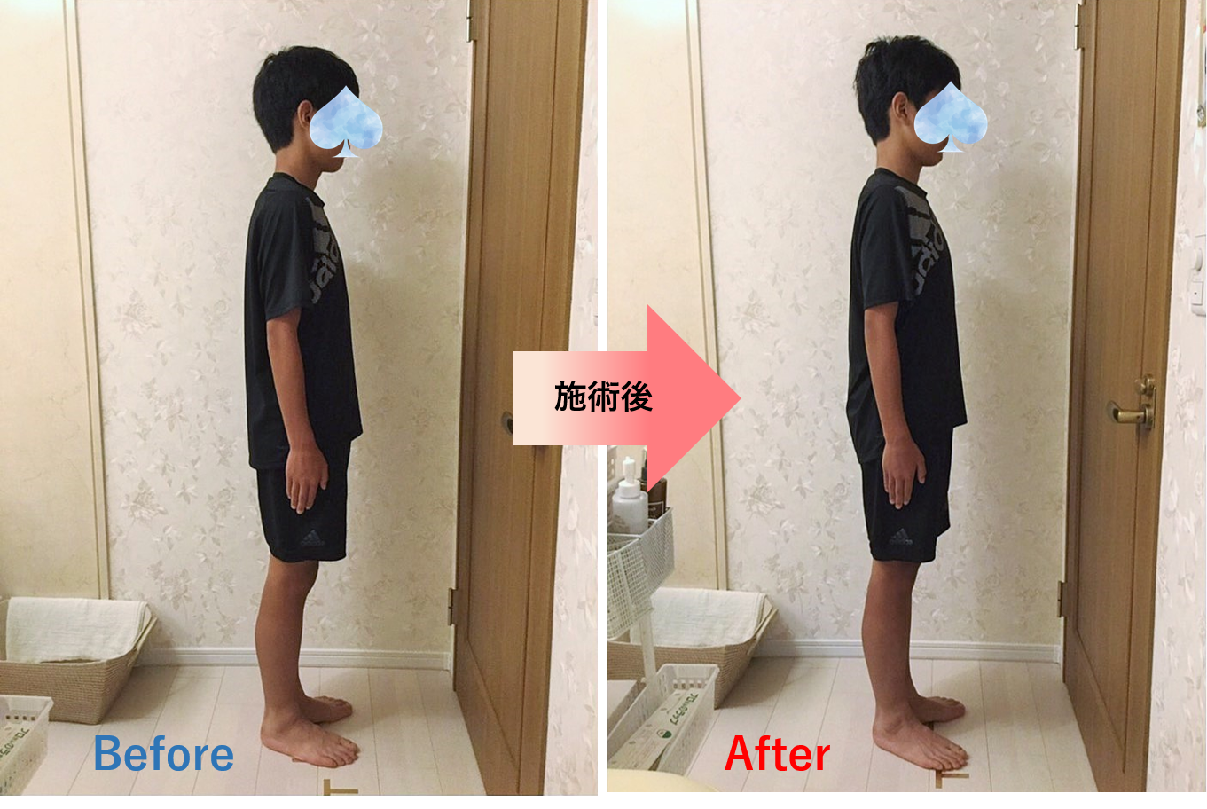 全身バランス矯正息子