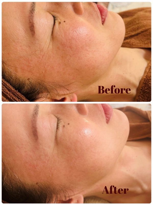 ゾンビパックビフォー・アフター